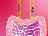 The Gut-Brain Connection